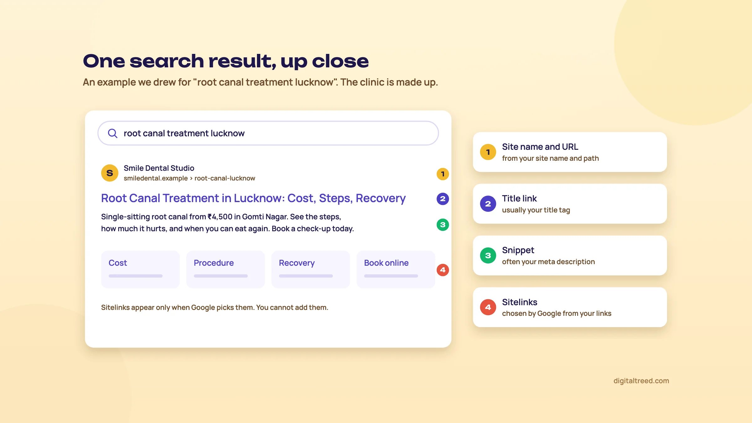 One drawn search result for "root canal treatment lucknow" with the site name and URL, title link, snippet and sitelinks labelled